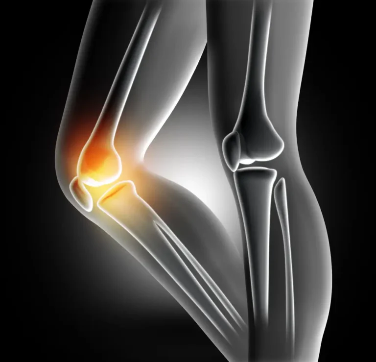Joint Pain Treatment